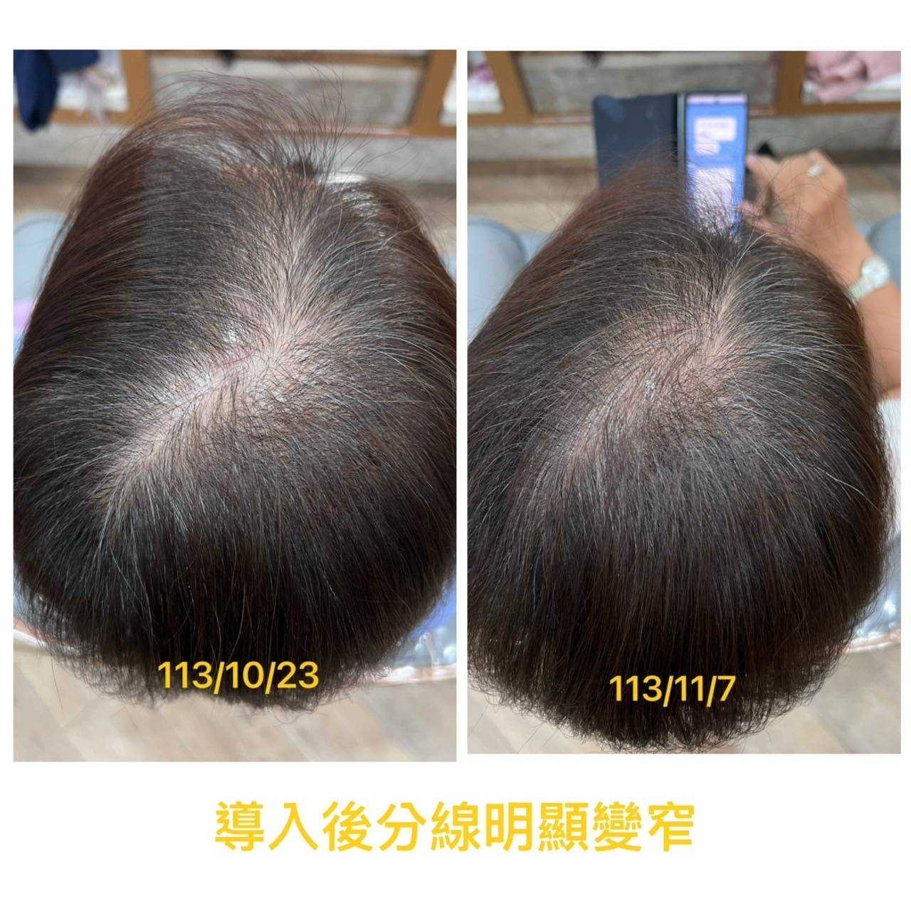鹿茸外泌體見證照