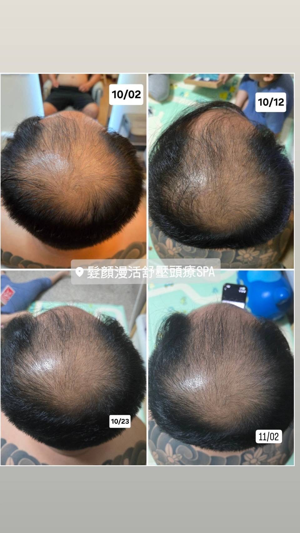 鹿茸外泌體見證照