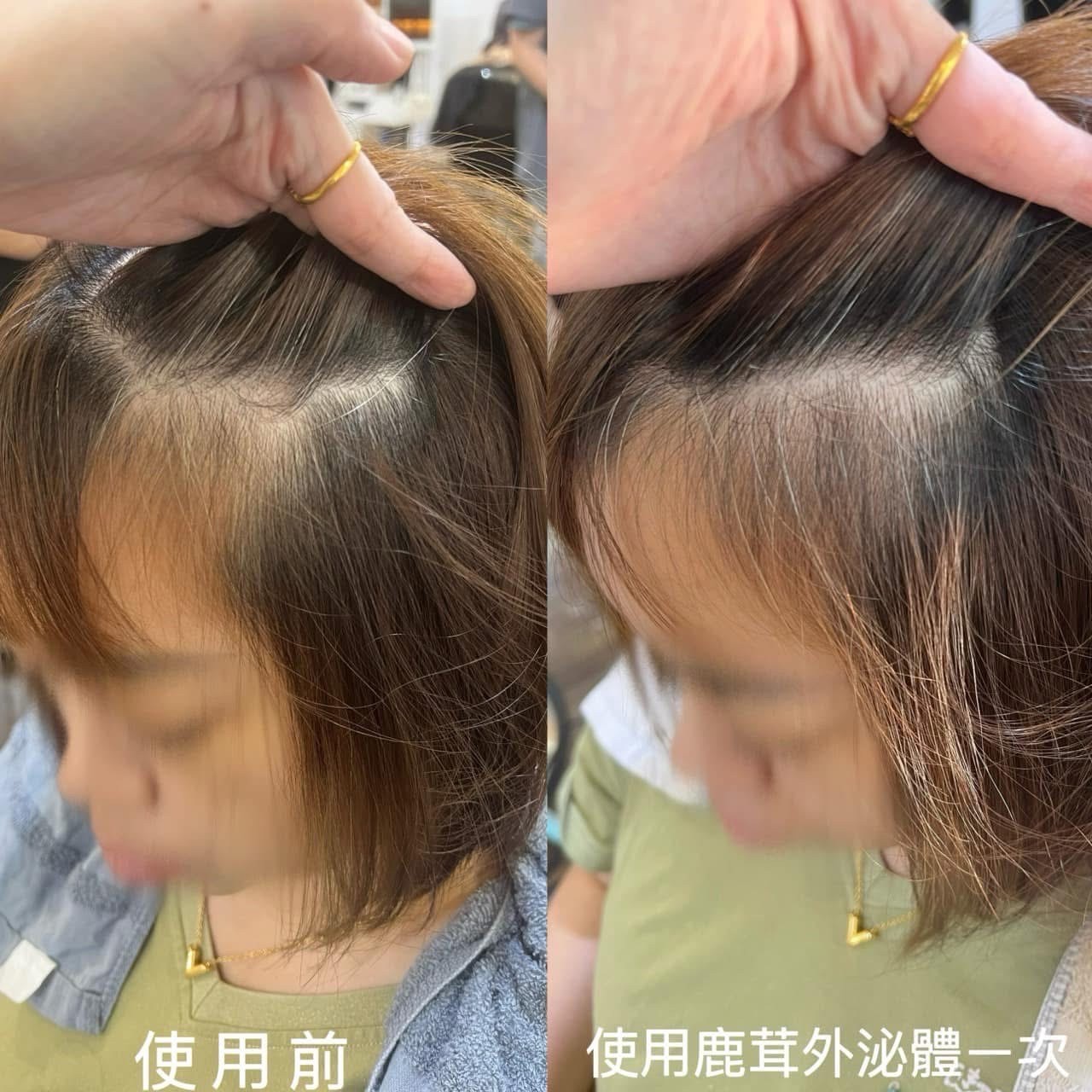 鹿茸外泌體見證照